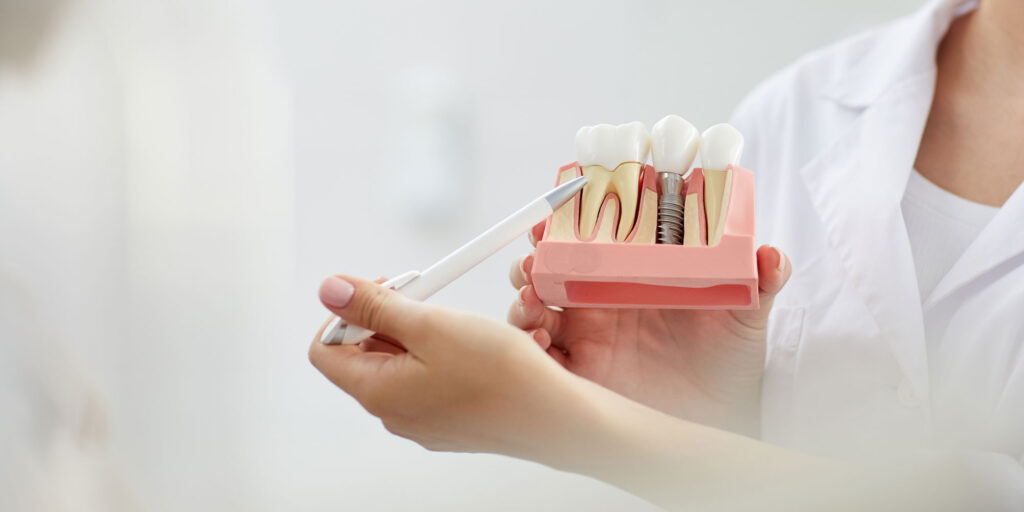 dental implant consultation